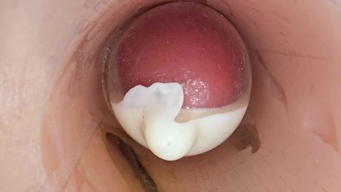 The camera in the deep pussy records a huge ejaculation of sperm into the condom